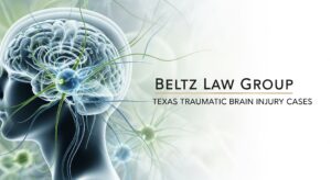 TBI Lawyer North Texas